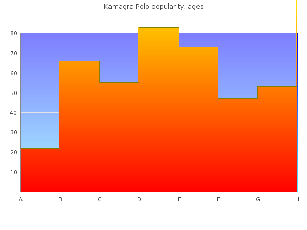 buy kamagra polo 100mg with mastercard
